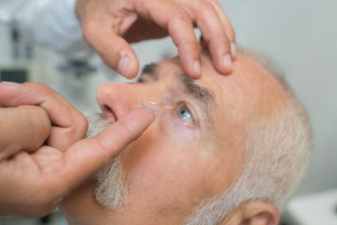 Application of a bespoke contact lens